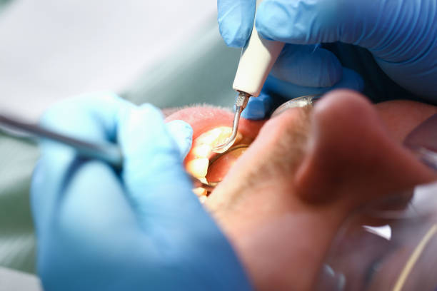 Best Emergency Dental Services for Seniors in Cedar Point, NC