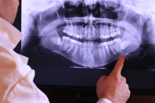 Best Emergency Dentist for Lost Fillings or Crowns in Cedar Point, NC