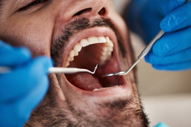Best Emergency Dentist for Special Needs Patients in Cedar Point, NC