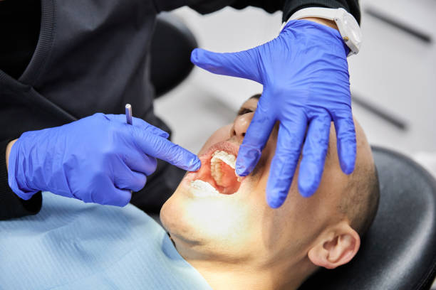Best Emergency Dental Care for Abscessed Tooth in Cedar Point, NC