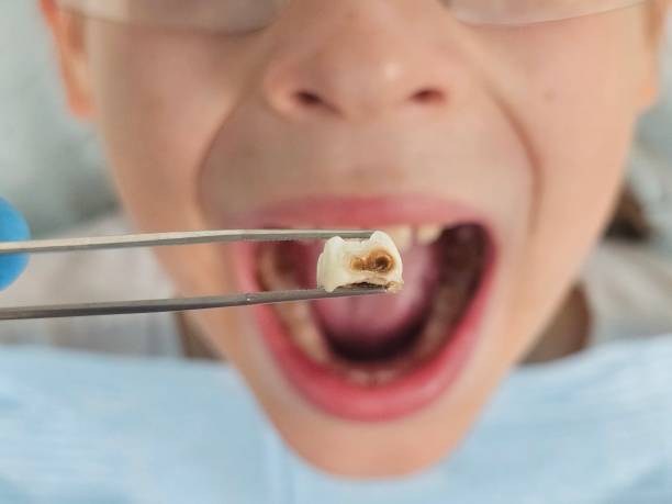 Best Orthodontic Emergency Dentist in Cedar Point, NC